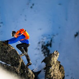 Matěj Bernát: Když se zubař podívá horám na zoubek 