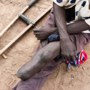 Následky války, Uganda