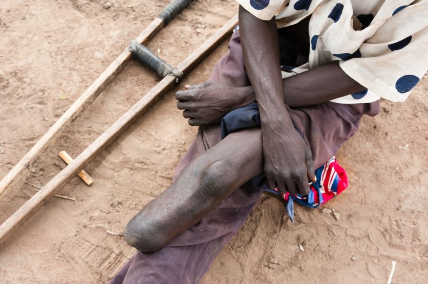 Následky války, Uganda