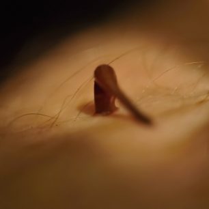 pijavice Haemadipsa sylvestris