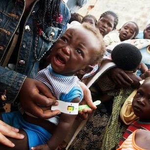 Podvýživa se u angolských dětí měří několika způsoby. Jedním ze způsobů je měření obvodu paže. (Foto: Michaela Sedláčková, ČvT)