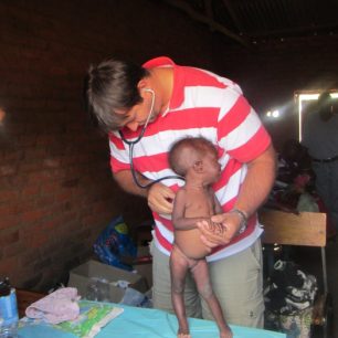 Vyšetření malé podvyživené pacientky, Malawi