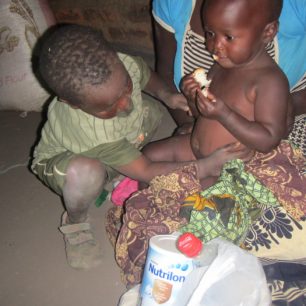 Podvyživený pacient, Malawi