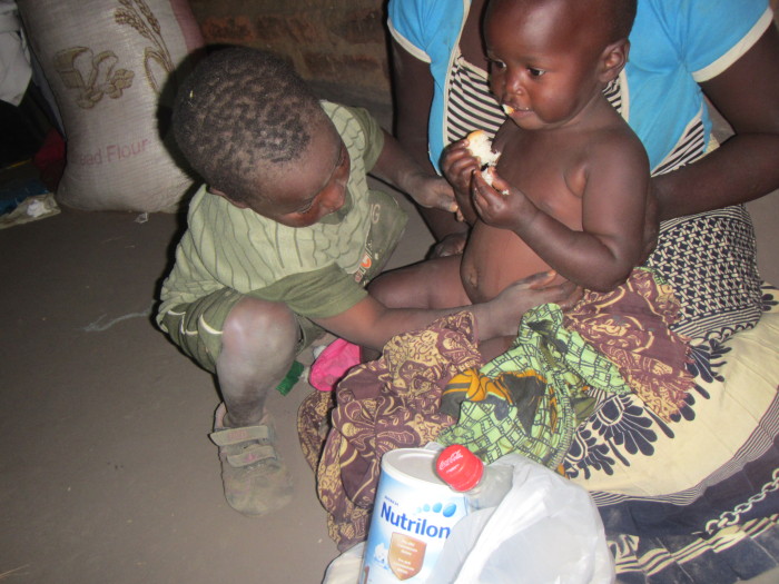 Podvyživený pacient, Malawi