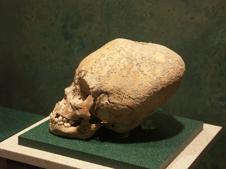 Deformované lebky byly znakem postavení a dětem byly modelovány již ve velmi nízkém věku, Mexiko