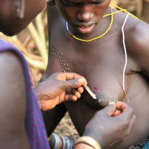 Ženy při rituálu, při kterém si zdobí tělo jizvami. /Foto Pavol Barabáš, IVan Bulík/