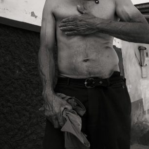 Prostřelený bok je připomínkou pekla, kterým si Enrique prošel. Kolumbie