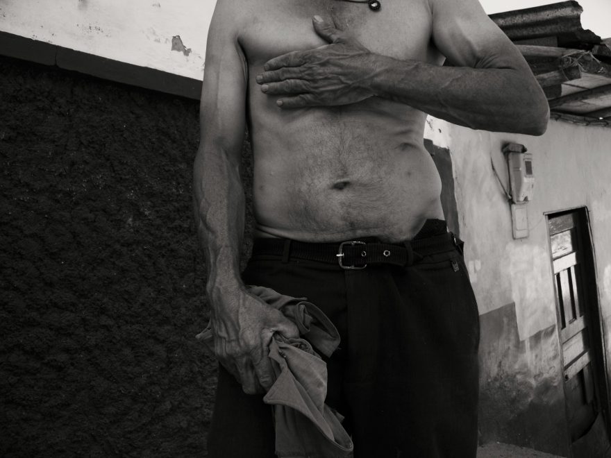 Prostřelený bok je připomínkou pekla, kterým si Enrique prošel. Kolumbie